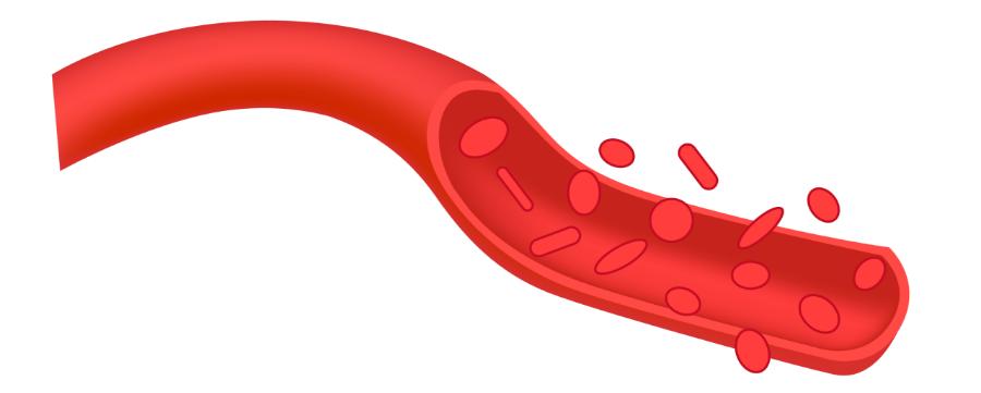 央视女主持人朱迅,艾灸朱迅