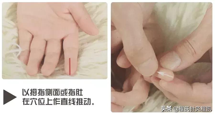 湿疹推拿要清脾还是补脾,小儿湿疹的推拿方法