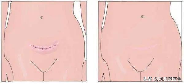 「免疫相关不良妊娠答疑解惑62」——分娩