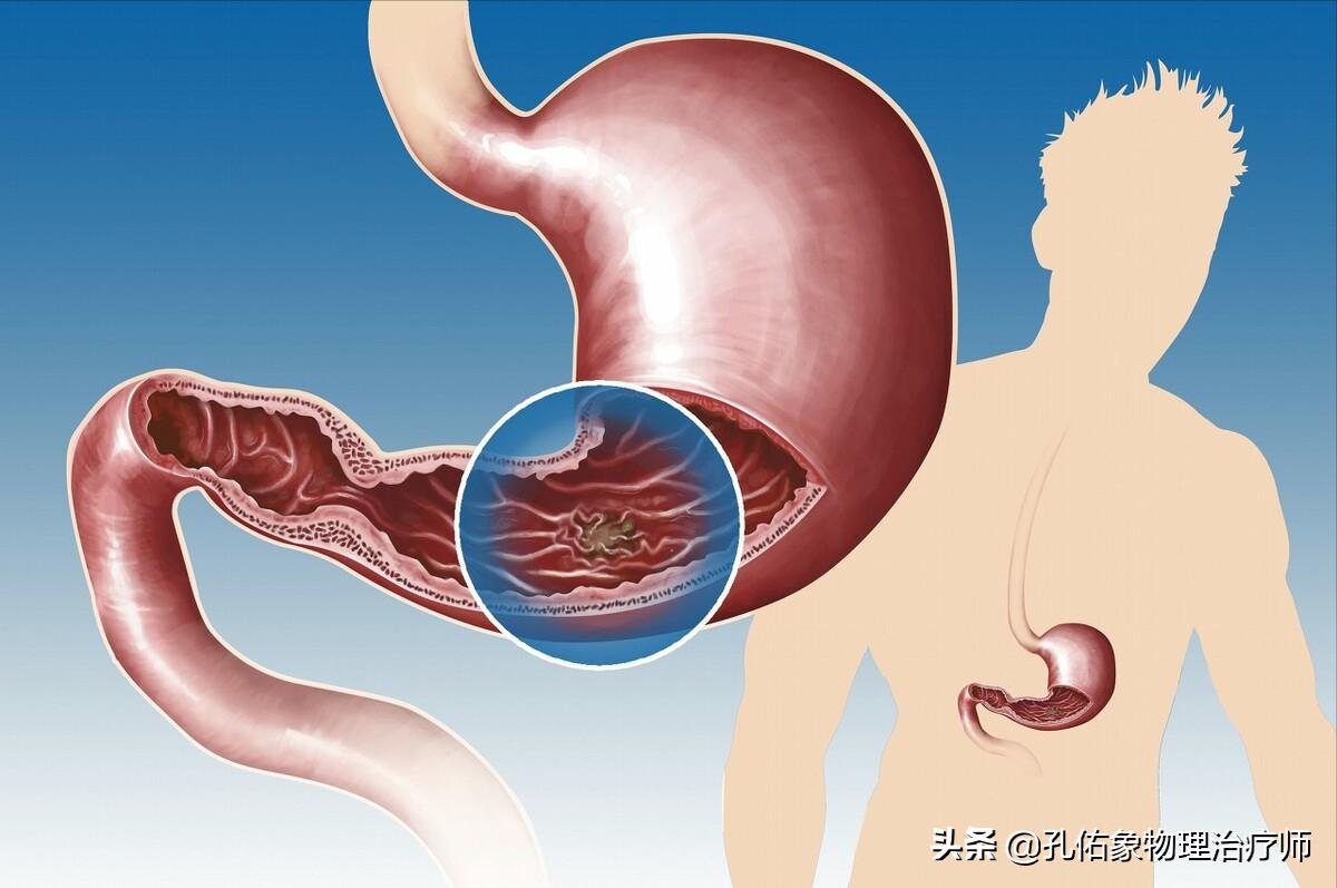 肩膀疼是肩周炎吗还是其他原因,肩周炎肩膀疼痛怎么锻炼