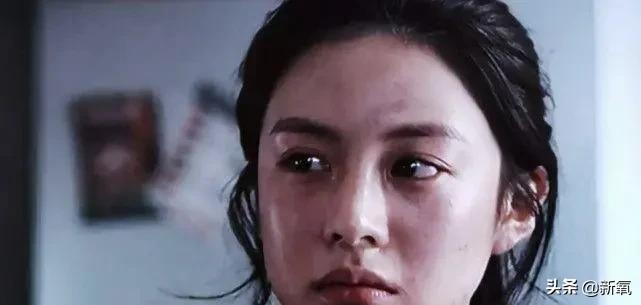 脸松弛下垂做哪种整形,面部下垂整形方法