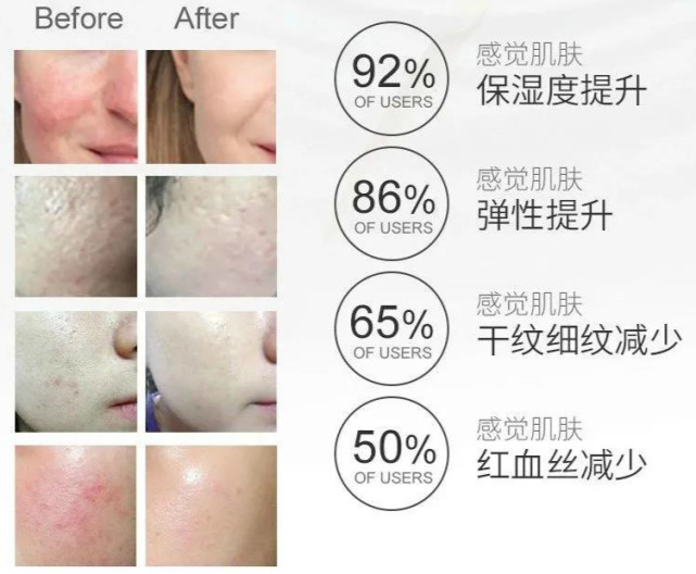 排名第一的胶原蛋白精华,类人胶原蛋白精华推荐