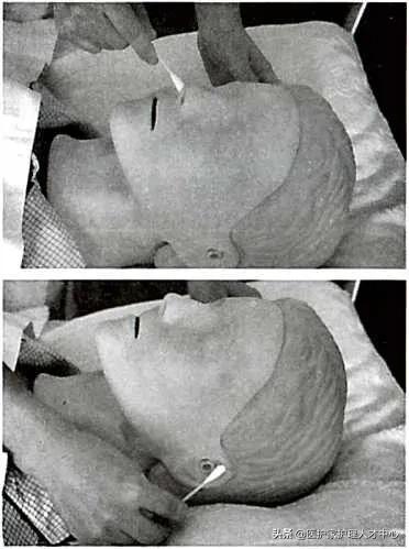 护理老人头发梳理与清洁,头部清理护理套餐