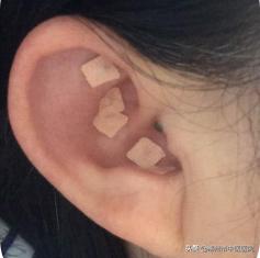 济南治月经不调中医哪里好,月经不调中医把脉什么意思