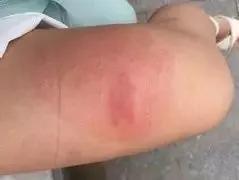 南方暴雨过后的水蚁有多可怕,暴雨后大水蚁怎么处理