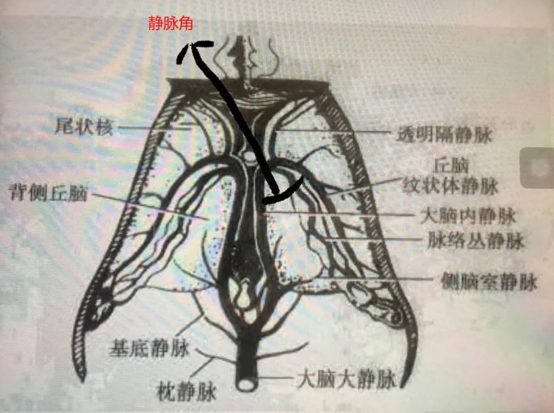 学习|颅脑静脉解剖及引流