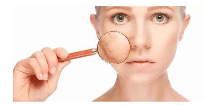 女人嘴周围长斑是什么原因,50岁女人长斑什么原因