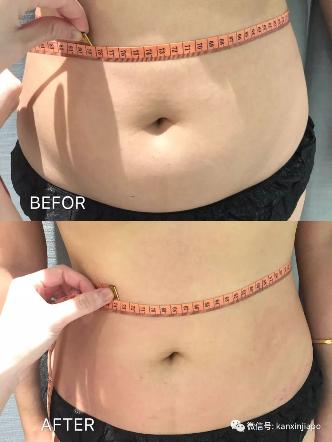 每周一次精准有效的皮肤管理,选对护肤方法让你做靓丽女神