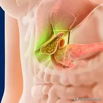 胆囊切除后吃什么植物油炒菜好,胆囊切除后吃油多了是什么症状