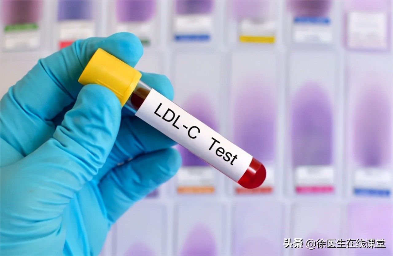 胆固醇6.6血脂3.06需要吃药吗,胆固醇跟血脂多少才需要吃药