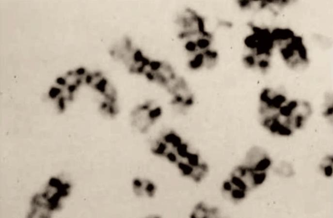 83天痛不欲生的活体腐烂，他在一次核事故后缓慢死去