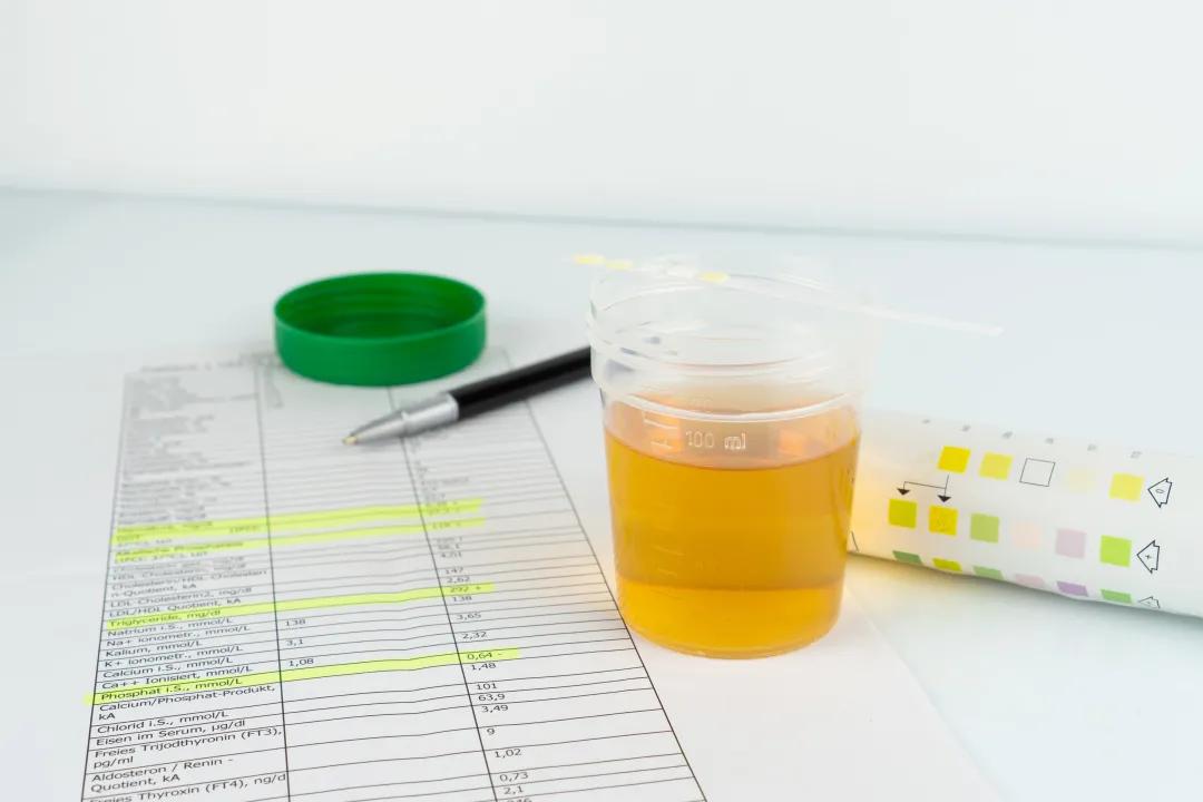 多饮多尿并非就是糖尿病,还可能...