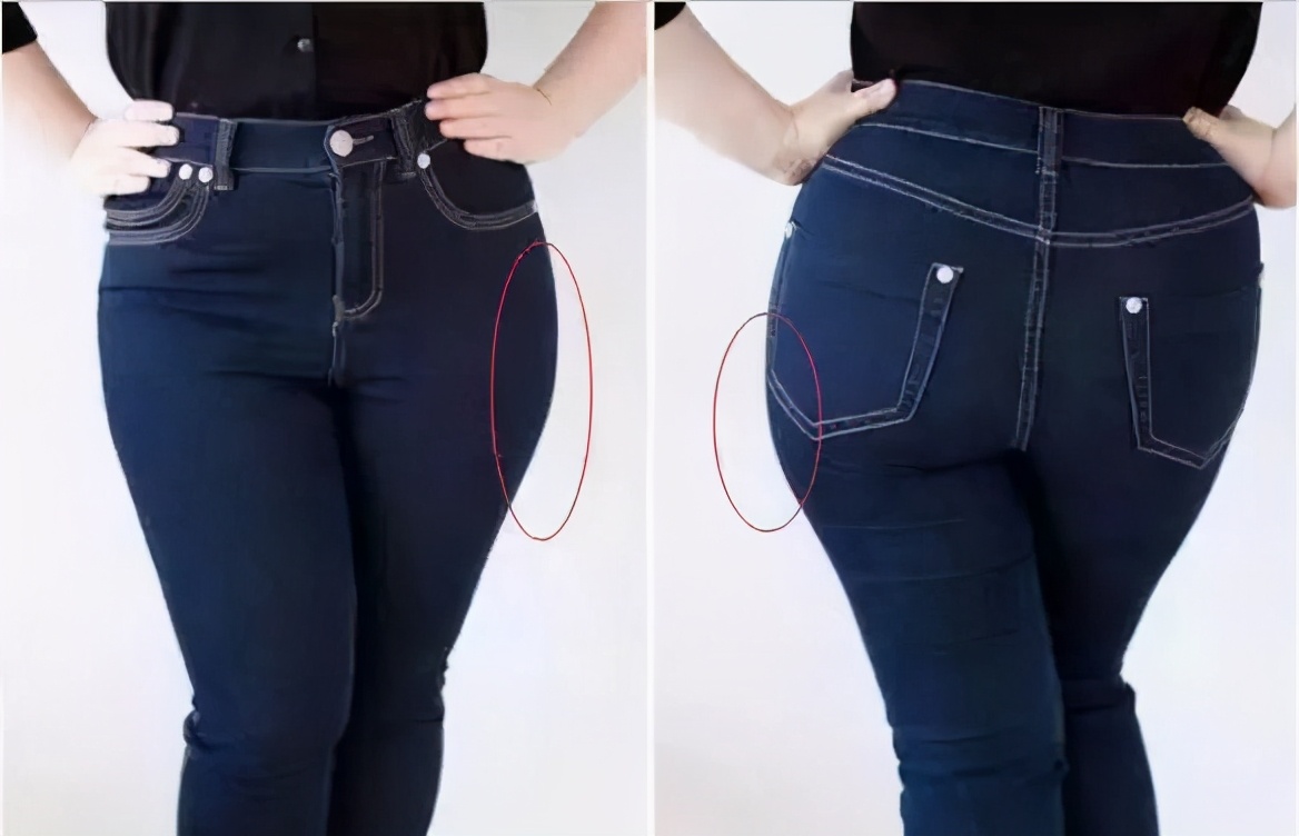 臀部扁平怎么练,臀部扁平下垂臀部有坑