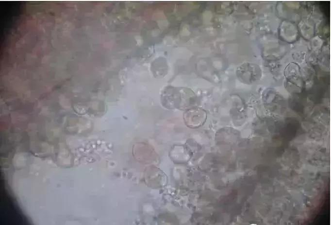 暴发“鱼瘟”救治时不可忽视寄生虫的危害---低温时节鱼类斜管虫病的症状及防治