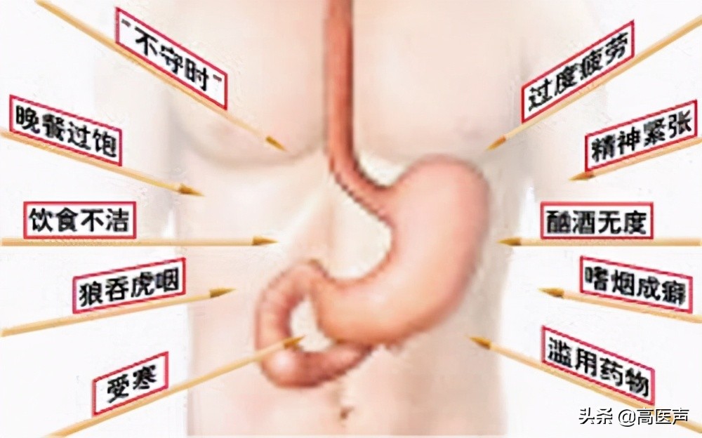 胃病胃糜烂看中医还是西医比较好,治疗胃病中医和西医哪个效果好