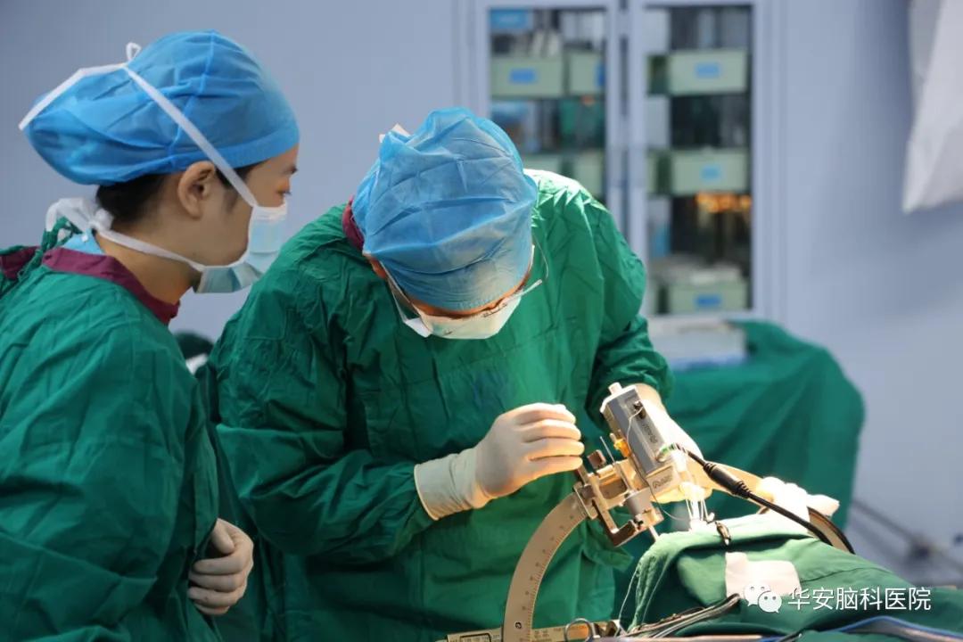 梅杰氏综合征dbs手术成功率,梅杰综合征微创手术打几个孔