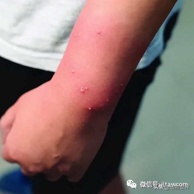 消灭入侵红火蚁,红火蚁入侵完整版