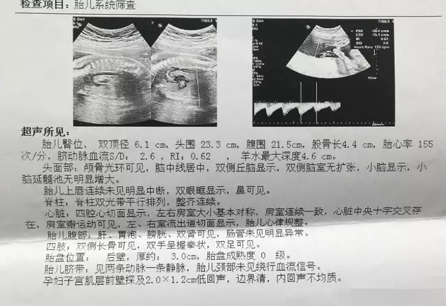 大排畸可以看出胎儿发育情况吗,胎儿小排畸结果数据怎么看