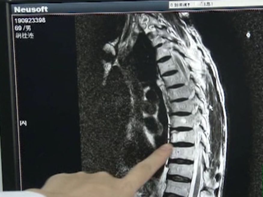 小孩发烧可以喝羊奶吗有没有影响,孩子喝鲜羊奶发烧怎么回事