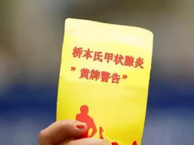 哪些人容易中桥本氏甲状腺炎的招?