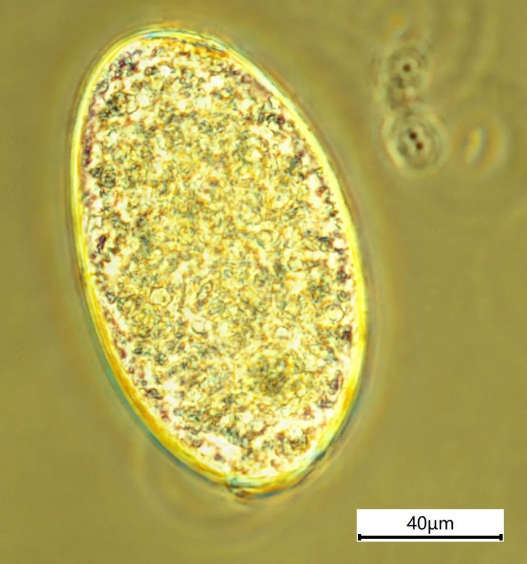 宠物寄生虫会传染人吗有什么症状,养宠物容易得寄生虫吗