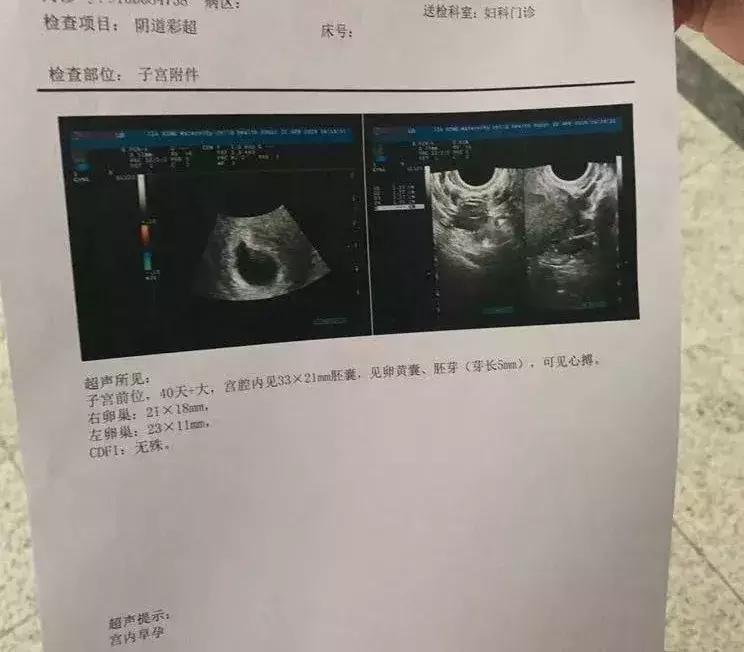 月经干净的第一天有怀孕的吗,月经干净第一天怀孕的有吗