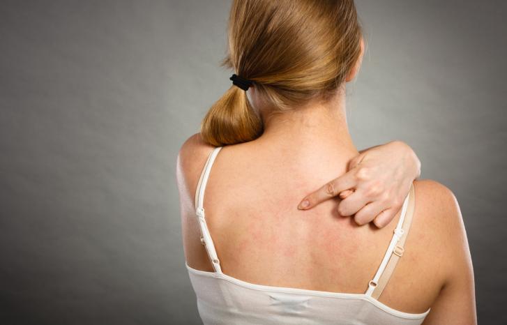 皮肤又红又痒又肿是什么原因,皮肤一抓就红而且凸起还痒怎么办