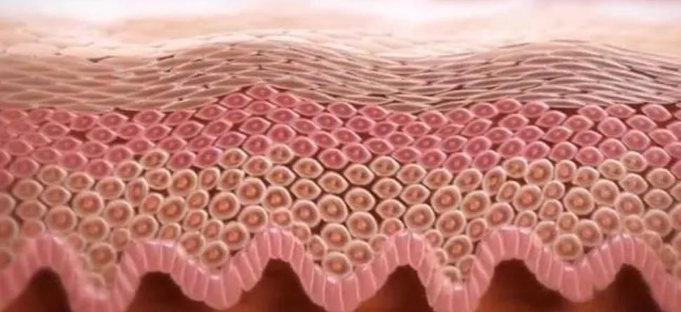 敏感肌红血丝易泛红怎么消除,敏感肌红血丝在护肤时应注意什么