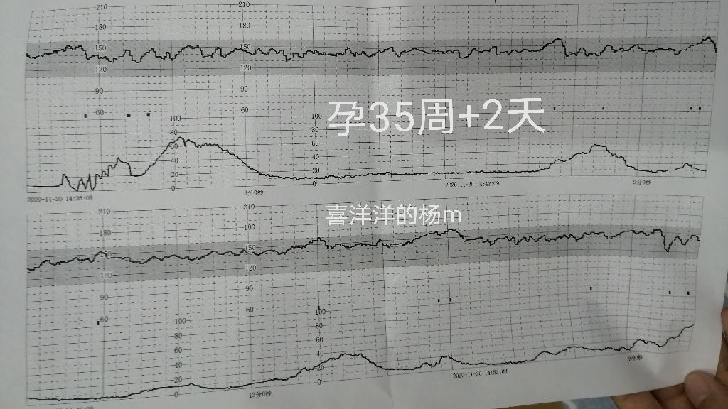 孕35周产检下午去吗,孕35周要做二次彩超
