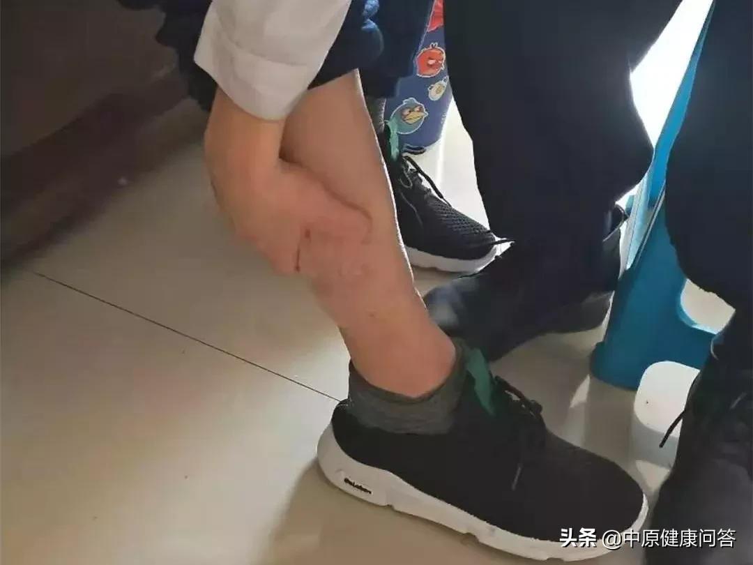 92岁老大爷家住5楼下不来，医生到家服务