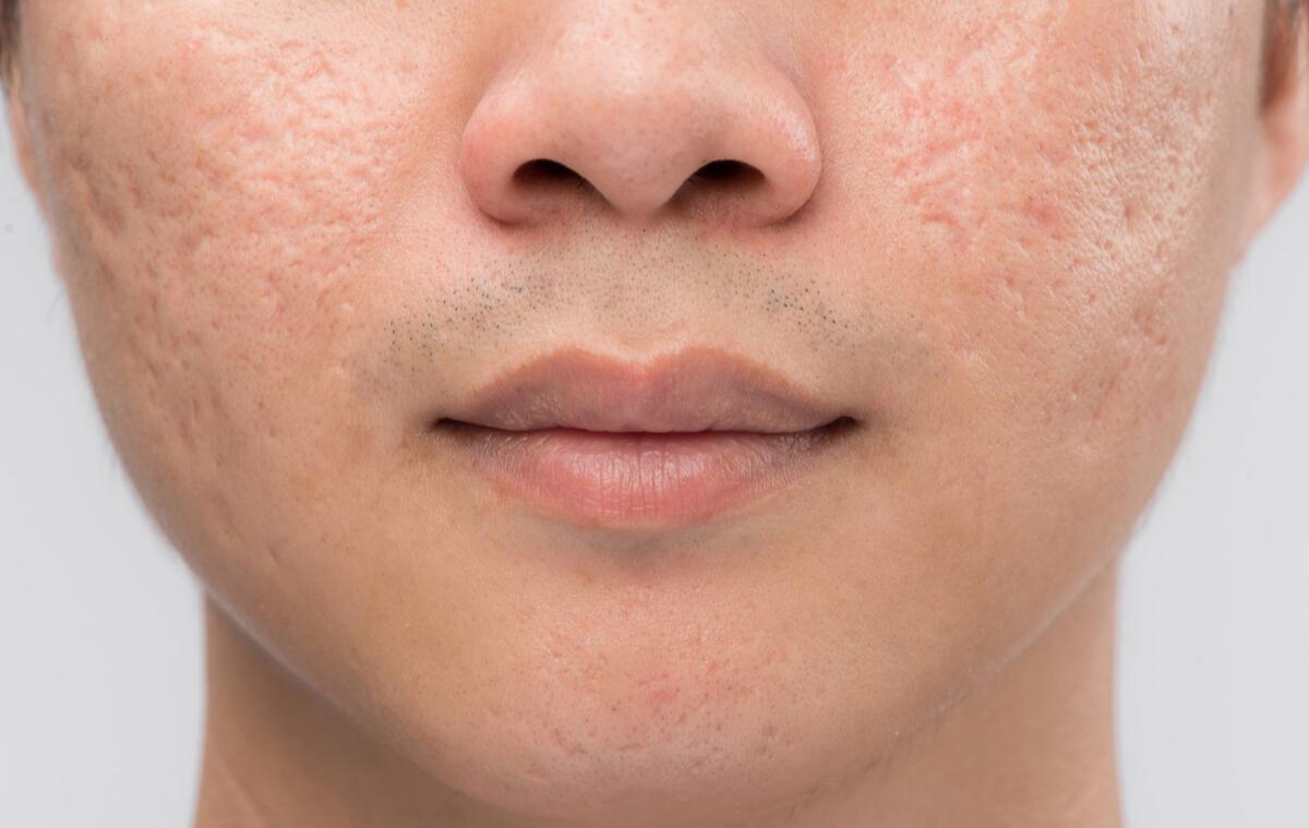 <html>
<head><title>502BadGateway</title></head>
<body>
<center><h1>502BadGateway</h1></center>
<hr><center>nginx</center>
</body>
</html>
<!--apaddingtodisableMSIEandChromefriendlyerrorpage-->
<!--apaddingtodisableMSIEandChromefriendlyerrorpage-->
<!--apaddingtodisableMSIEandChromefriendlyerrorpage-->
<!--apaddingtodisableMSIEandChromefriendlyerrorpage-->
<!--apaddingtodisableMSIEandChromefriendlyerrorpage-->
<!--apaddingtodisableMSIEandChromefriendlyerrorpage-->
