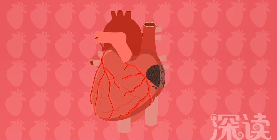 网约车司机猝死跟什么有关,网约车司机疑因疲劳过度猝死