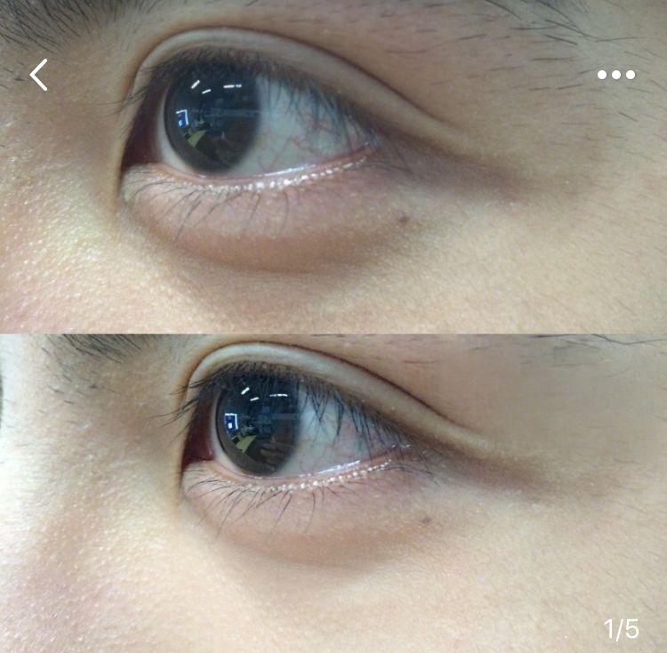 陆毅推荐眼膜,陆毅贝儿眼膜