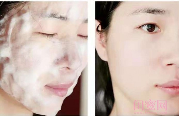 皮肤又干又黄又有斑,脸部肌肤泡泡浴