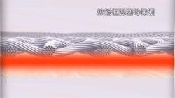 治疗老寒腿的电疗护膝,老寒腿护膝黑科技产品