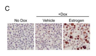 抗癌重大突破国内首例til治疗,三阴性乳腺癌adc治疗成功率