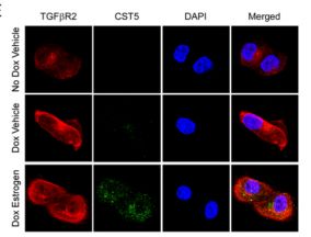 抗癌重大突破国内首例til治疗,三阴性乳腺癌adc治疗成功率