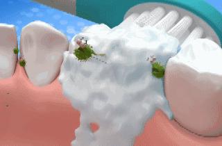 一直有口臭吃什么内调,如何从根本上解决口臭的问题