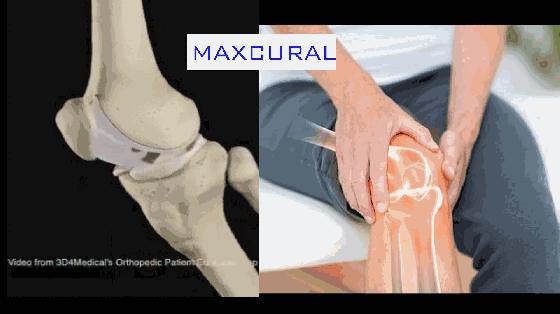 肩颈疼痛膏日本,澳洲缓解关节疼痛霜