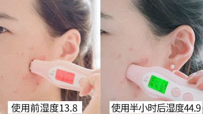 用香皂洗脸去油祛痘,硫磺香皂洗脸可以祛痘去油吗