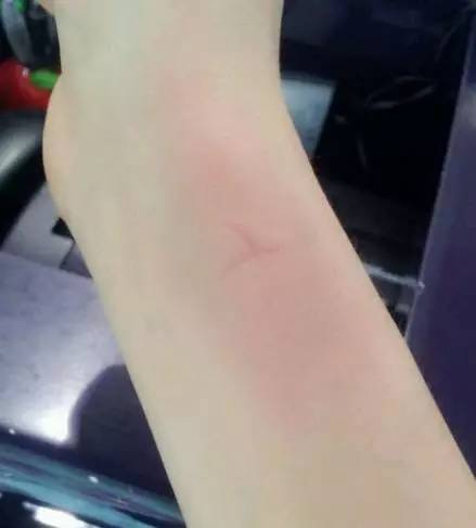 小时候的夏天为什么不热,小时候为什么不怕热