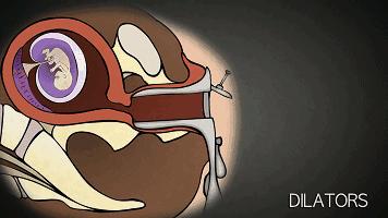 多次打胎真实案例,25岁女生接受多少次打胎