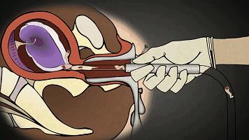 啪啪啪被孩子撞见，并问“你们在干嘛？”高明的家长是这样回答的