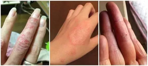 泰国手霜,泰国精油手霜