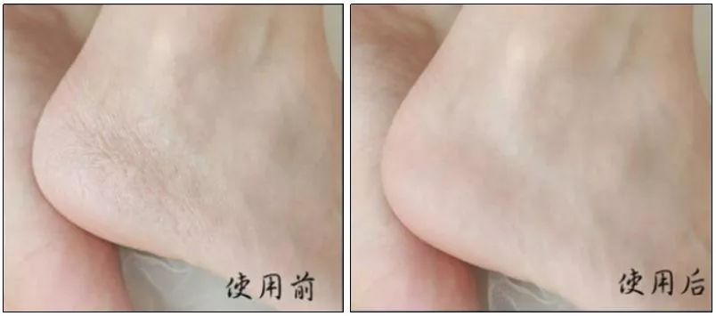 泰国手霜,泰国精油手霜