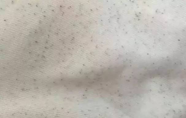 衣服上的黑点洗不干净,衣服有小黑点洗不掉怎么办