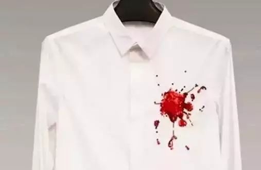 衣服上的黑点洗不干净,衣服有小黑点洗不掉怎么办