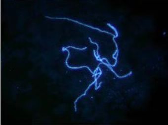 奇怪！杭州两女孩合租一间房得了一样的病！胳膊上都长了像钱币一样的疹子……