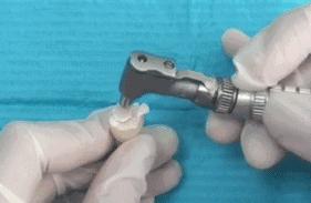 进行防龋齿牙齿窝沟封闭工作,窝沟封闭是保护牙齿最有效的方式