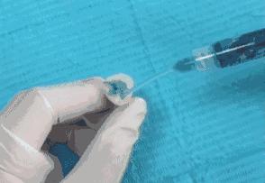 进行防龋齿牙齿窝沟封闭工作,窝沟封闭是保护牙齿最有效的方式